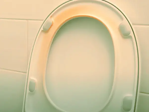 How to remove urine stains from toilet seat