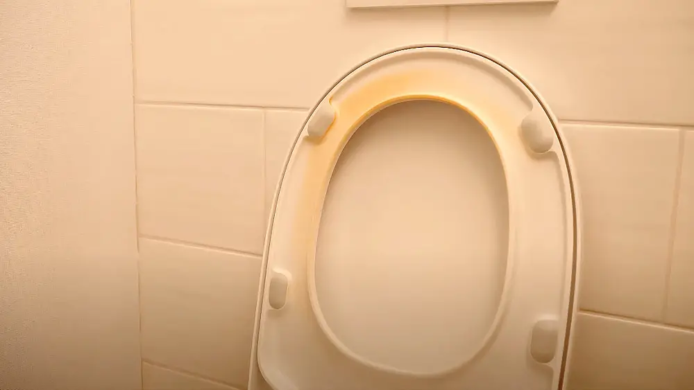 Remove urine stains from toilet seat